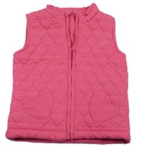 Růžová šusťáková prošívaná zateplená vesta Topolino