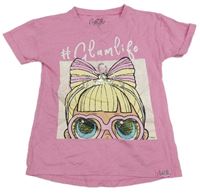 Růžové tričko s potiskem LOL Suprise Nutmg 